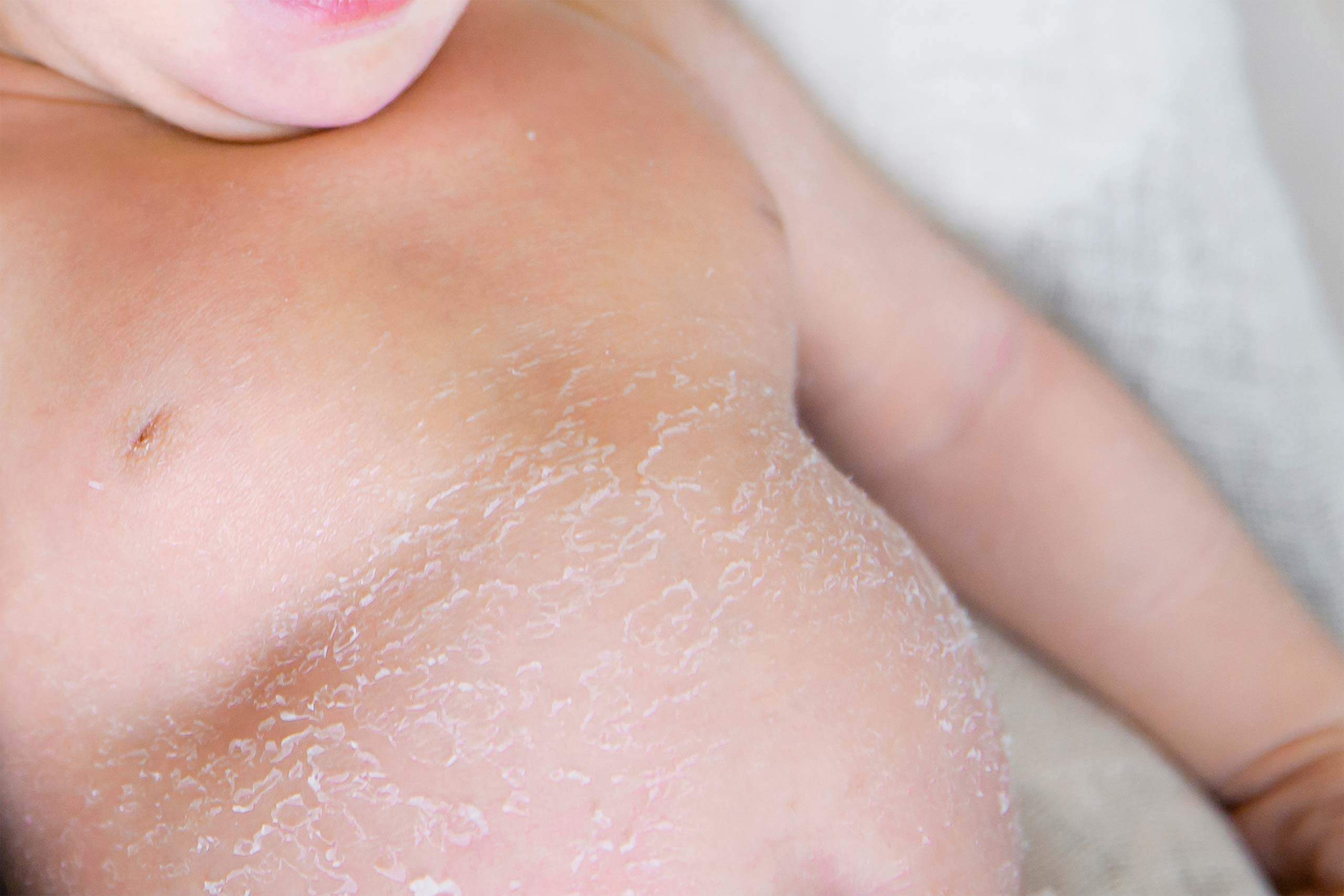 お顔の皮がむける 新生児落屑 について コラム 浜松の写真スタジオ Fotologue フォトローグ